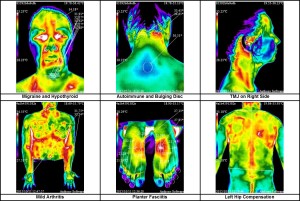 thermography-table-1-jpeg
